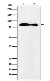 Anti-VPS35 Monoclonal Antibody Boster Bio