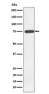 Anti-GNE Rabbit Monoclonal Antibody Boster Bio