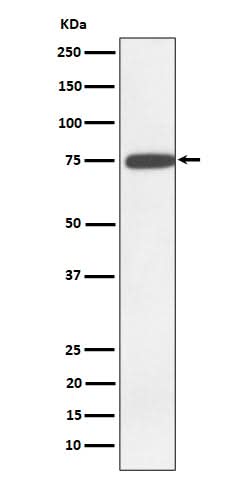 Anti-GNE Rabbit Monoclonal Antibody Boster Bio
