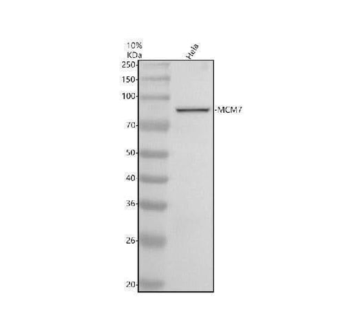Anti-MCM7 Monoclonal Antibody Boster Bio