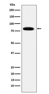 Anti-MCM7 Rabbit Monoclonal Antibody Boster Bio