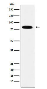 Anti-MCM7 Rabbit Monoclonal Antibody Boster Bio
