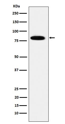 Anti-MCM7 Rabbit Monoclonal Antibody Boster Bio