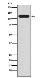 Anti-MUC4 Rabbit Monoclonal Antibody Boster Bio