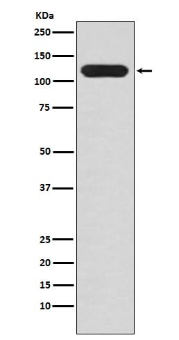 Anti-MUC4 Rabbit Monoclonal Antibody Boster Bio