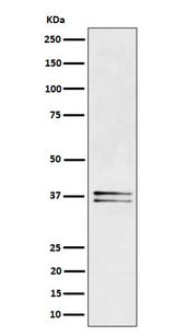 Anti-LAT Rabbit Monoclonal Antibody Boster Bio