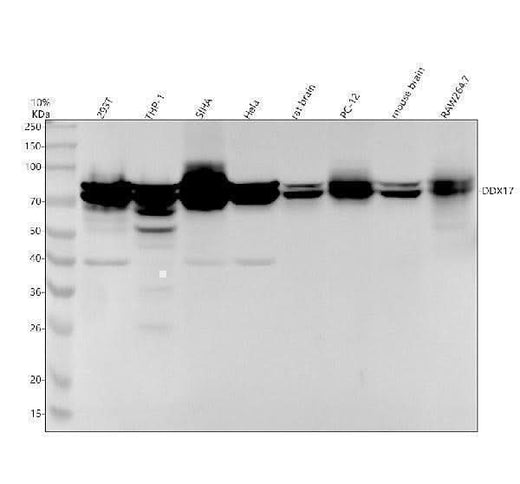 Anti-DDX17 Rabbit Monoclonal Antibody Boster Bio