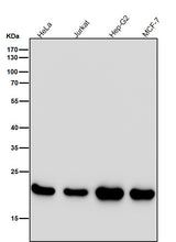 Anti-PEBP1/Pbp Rabbit Monoclonal Antibody Boster Bio