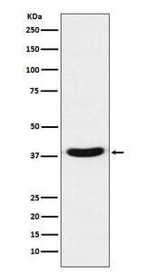 Anti-TRBP Monoclonal Antibody Boster Bio