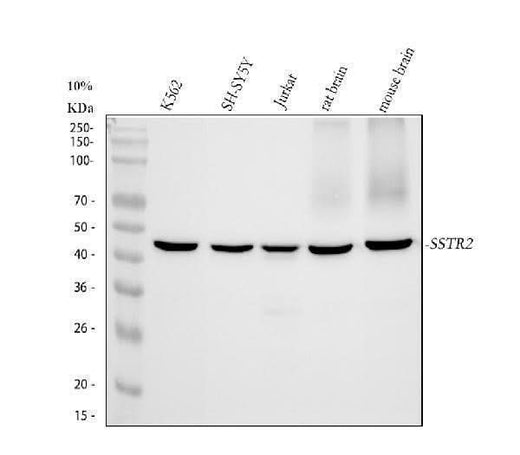 Anti-Somatostatin Receptor 2 SSTR2 Rabbit Monoclonal Antibody Boster Bio