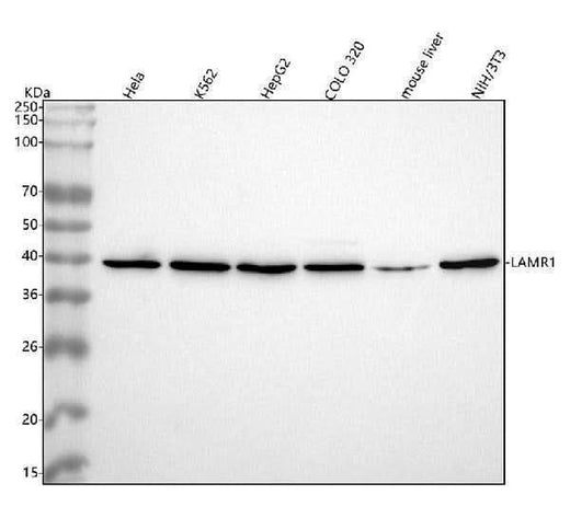 Anti-67kDa Laminin Receptor RPSA Rabbit Monoclonal Antibody Boster Bio