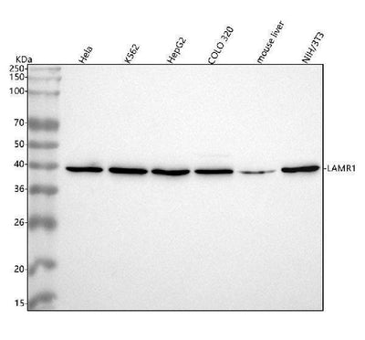 Anti-67kDa Laminin Receptor RPSA Rabbit Monoclonal Antibody Boster Bio