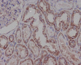 Anti-Hsp90 beta HSP90AB1 Rabbit Monoclonal Antibody Boster Bio