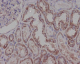 Anti-Hsp90 beta HSP90AB1 Rabbit Monoclonal Antibody Boster Bio