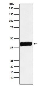 Anti-Creatine kinase B type CKB Monoclonal Antibody Boster Bio