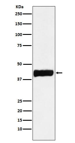 Anti-Creatine kinase B type CKB Monoclonal Antibody Boster Bio