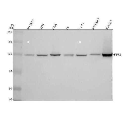 Anti-DDR2 Monoclonal Antibody Boster Bio