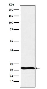 Anti-GLO1 Monoclonal Antibody Boster Bio