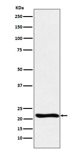 Anti-GLO1 Monoclonal Antibody Boster Bio