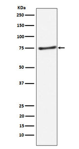 Anti-PIAS1 Rabbit Monoclonal Antibody Boster Bio