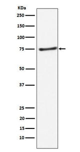 Anti-PIAS1 Rabbit Monoclonal Antibody Boster Bio