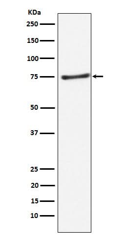 Anti-PIAS1 Rabbit Monoclonal Antibody Boster Bio