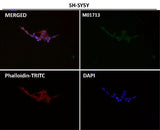 Anti-EAAT2/GLT-1/SLC1A2 Rabbit Monoclonal Antibody Boster Bio