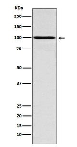 Anti-IFNGR1 Rabbit Monoclonal Antibody Boster Bio
