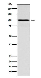 Anti-IFNGR1 Rabbit Monoclonal Antibody Boster Bio