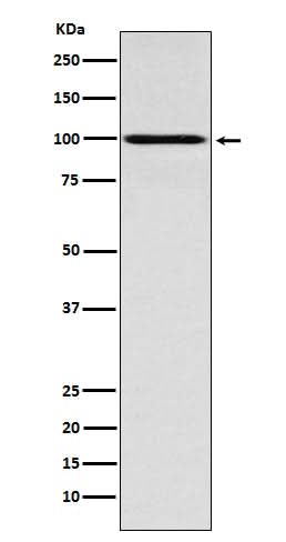 Anti-IFNGR1 Rabbit Monoclonal Antibody Boster Bio