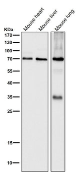Anti-SAM68 Rabbit Monoclonal Antibody Boster Bio