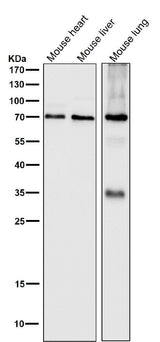 Anti-SAM68 Rabbit Monoclonal Antibody Boster Bio