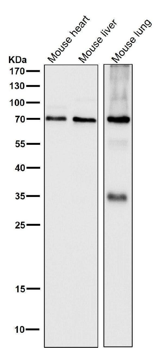 Anti-SAM68 Rabbit Monoclonal Antibody Boster Bio