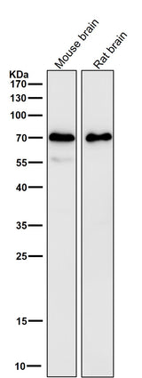 Anti-SAM68 Rabbit Monoclonal Antibody Boster Bio