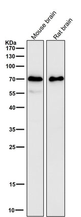 Anti-SAM68 Rabbit Monoclonal Antibody Boster Bio