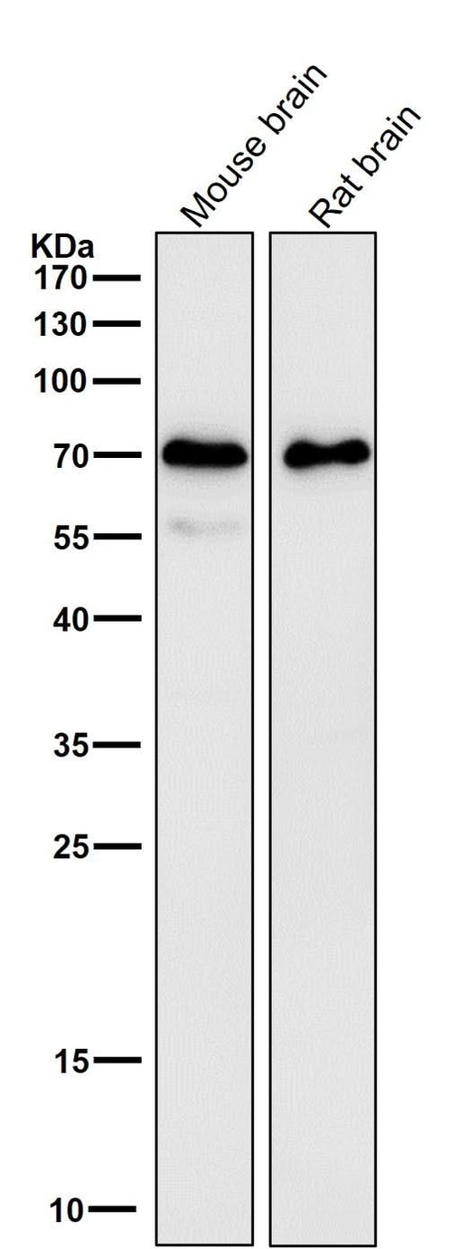 Anti-SAM68 Rabbit Monoclonal Antibody Boster Bio