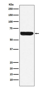 Anti-Placental alkaline phosphatase (PLAP) Rabbit Monoclonal Antibody Boster Bio