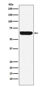 Anti-Placental alkaline phosphatase (PLAP) Rabbit Monoclonal Antibody Boster Bio