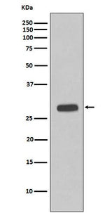 Anti-Troponin I Rabbit Monoclonal Antibody Boster Bio