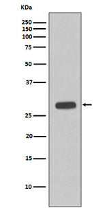 Anti-Troponin I Rabbit Monoclonal Antibody Boster Bio