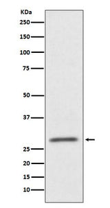 Anti-CD99 Rabbit Monoclonal Antibody Boster Bio