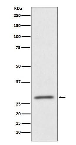 Anti-CD99 Rabbit Monoclonal Antibody Boster Bio