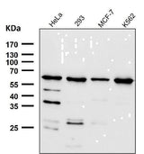 Anti-HRPT2 / CDC73 Rabbit Monoclonal Antibody Boster Bio