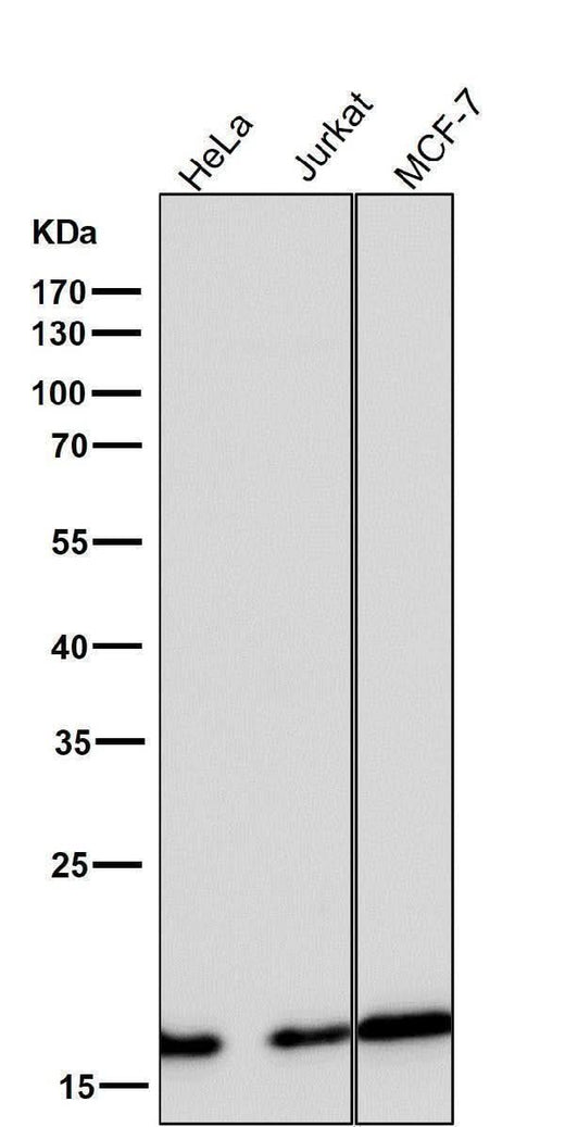 Anti-eIF5A Rabbit Monoclonal Antibody Boster Bio