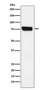Anti-HEC1 NDC80 Monoclonal Antibody Boster Bio