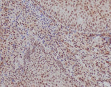 Anti-Ku70 XRCC6 Rabbit Monoclonal Antibody Boster Bio