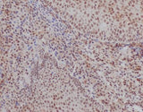 Anti-Ku70 XRCC6 Rabbit Monoclonal Antibody Boster Bio