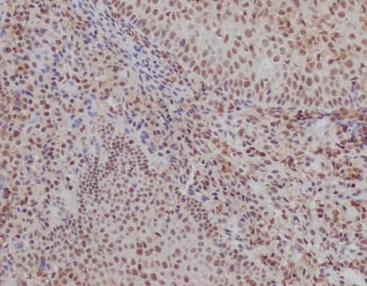 Anti-Ku70 XRCC6 Rabbit Monoclonal Antibody Boster Bio