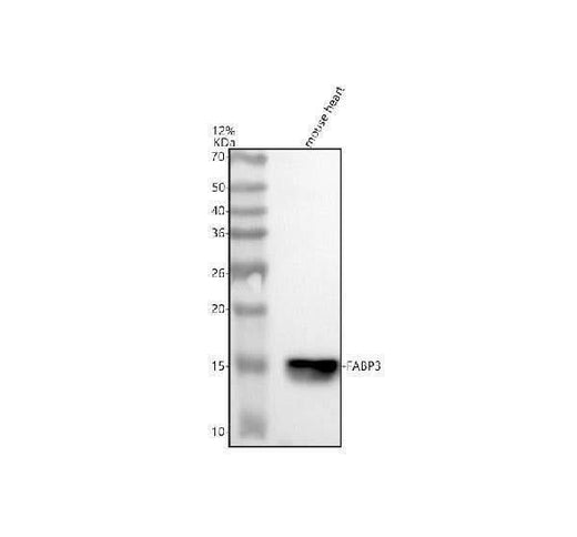 Anti-FABP3 Rabbit Monoclonal Antibody Boster Bio