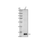 Anti-Trefoil Factor 3 Monoclonal Antibody Boster Bio